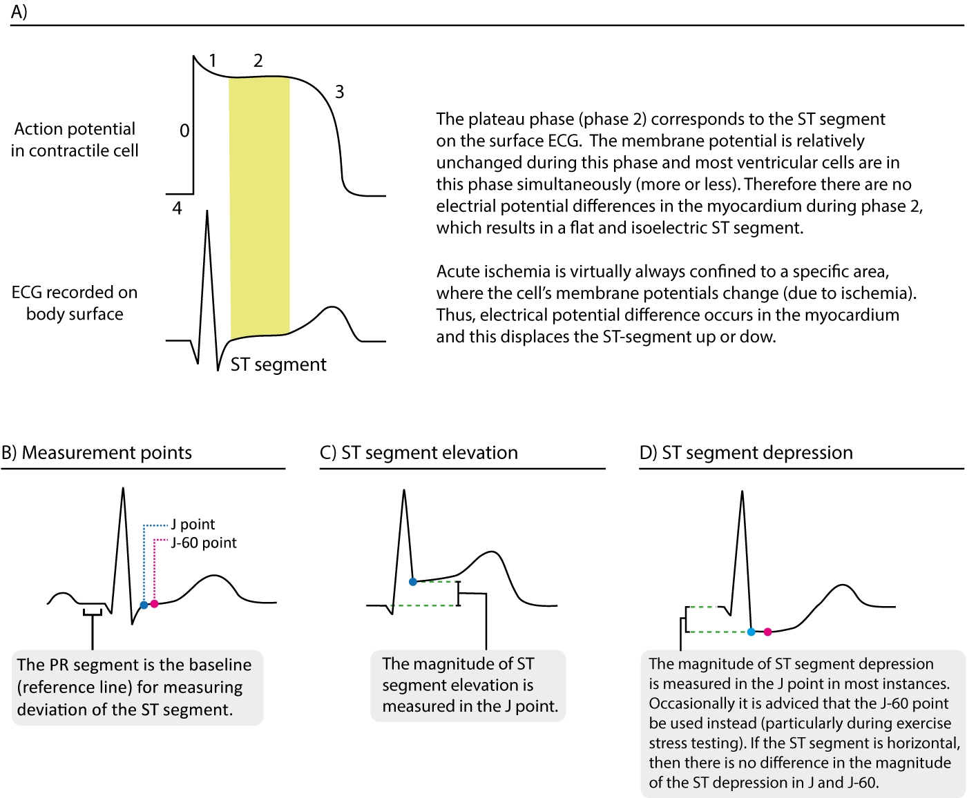 The ST Segment Physiology Normal Appearance ST Depression ST 